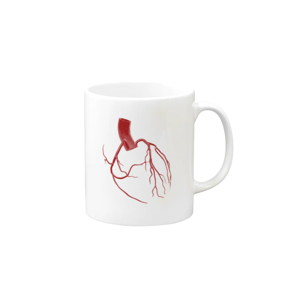 からばく社のレントゲン(冠動脈) Mug :right side of the handle