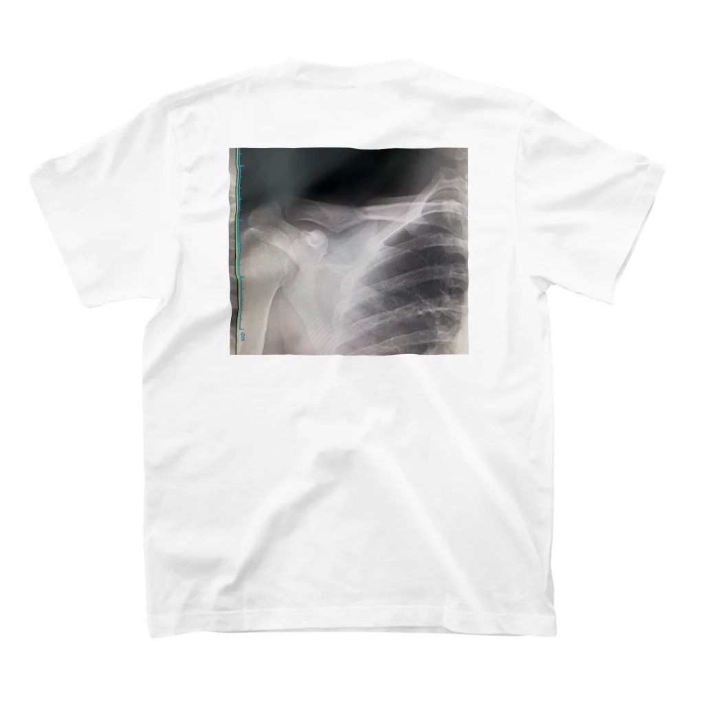 個性派の鎖骨骨折記念日 Regular Fit T-Shirtの裏面