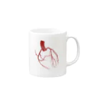 からばく社のレントゲン(冠動脈) Mug :right side of the handle