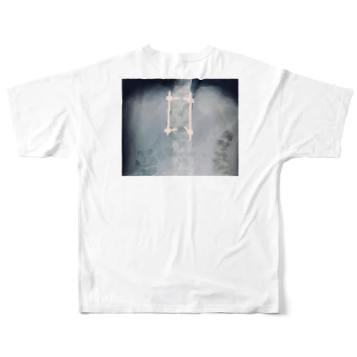 背骨治りますようにグッズ All-Over Print T-Shirt