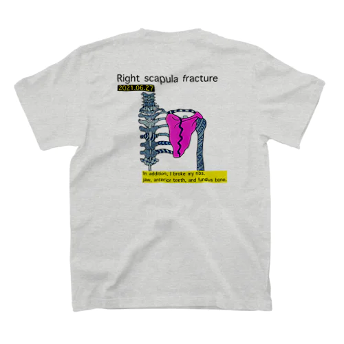 右肩甲骨骨折2 Regular Fit T-Shirt